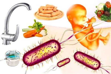 Listeriosis en el embarazo: cuáles son los alimentos。